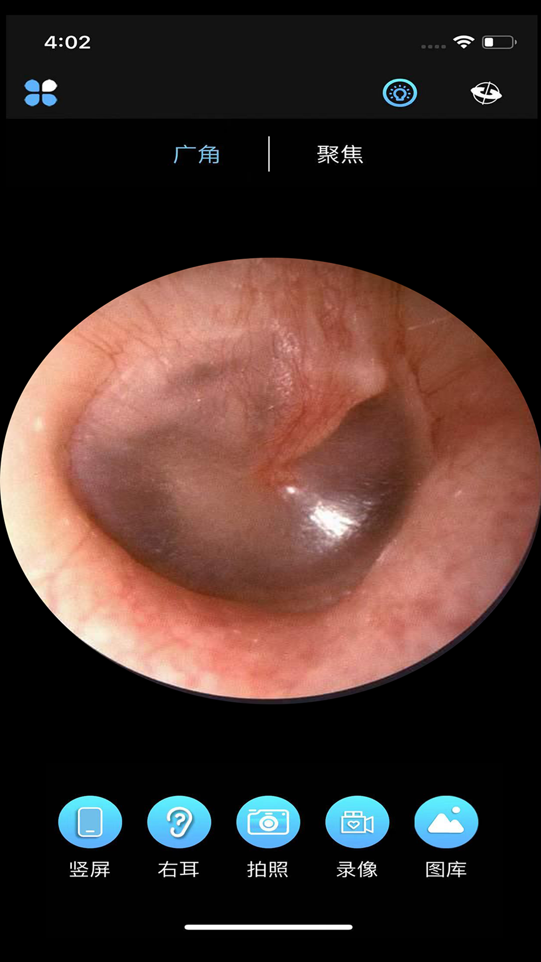 ALK(可视采耳设备app) ALK(可视采耳设备app)