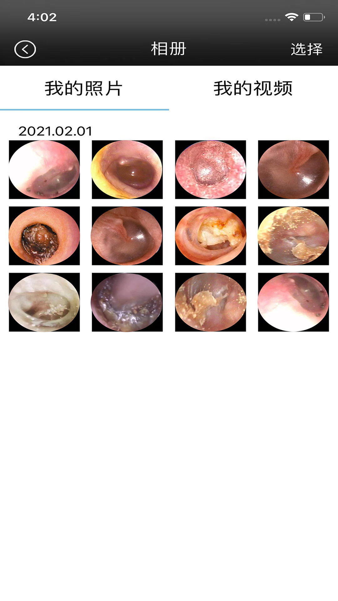 ALK(可视采耳设备app) ALK(可视采耳设备app)