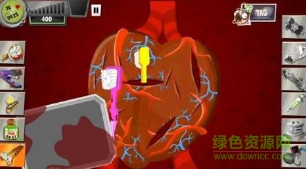 疯狂外科医生3最新版 疯狂外科医生3最新版